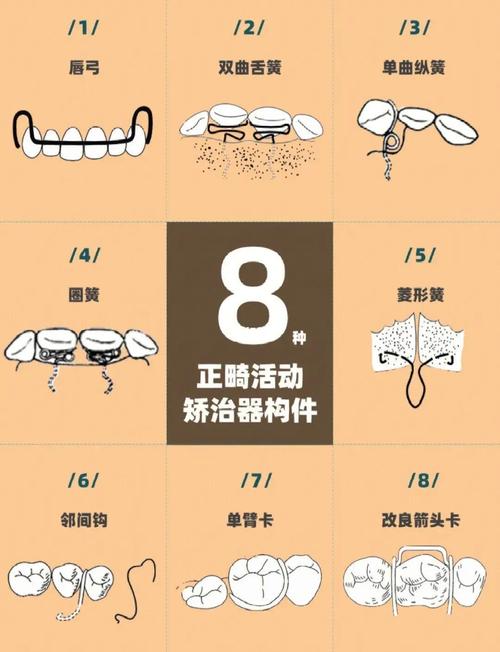 固定义齿有几种分类方法-图1