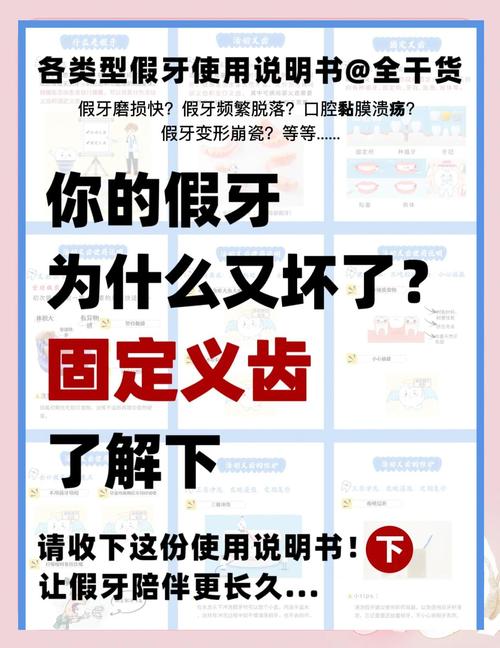 固定义齿有几种分类方法-图3