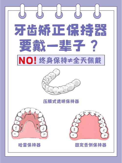 正畸前为什么要戴保持器-图1 正畸前为什么要戴保持器-图1