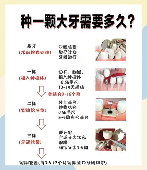 种牙的种类与要多少钱-图1