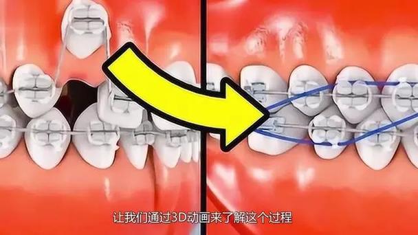 哪里有正规的3D正畸排牙软件?求推荐靠谱的获取渠道和方式?-图1 哪里有正规的3D正畸排牙软件?求推荐靠谱的获取渠道和方式?-图1