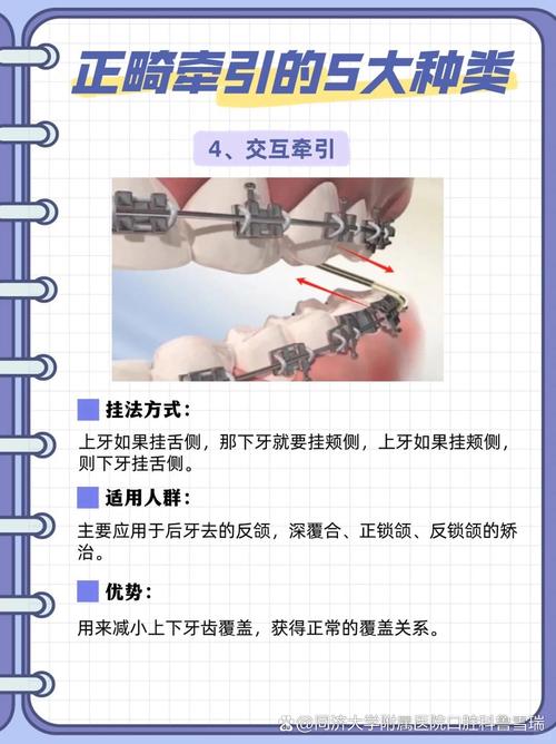 牙正畸近中牵引的作用有哪些？-图3