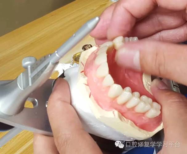 舌侧集中颌排牙方法图片如何直观展示排牙步骤与技巧要点？-图2