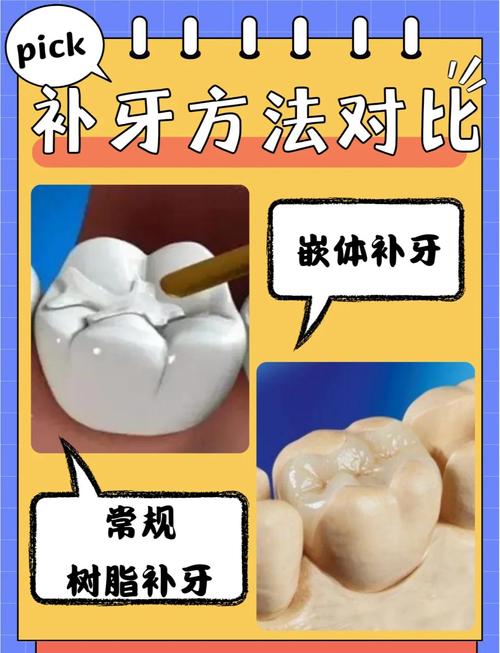 牙体缺损粘结修复有哪些常用方法？-图1