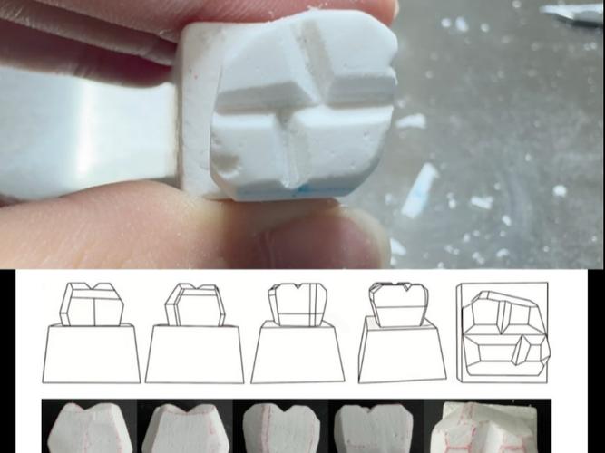 下颌6牙蜡雕刻步骤方法有哪些？详细步骤如何操作？-图1