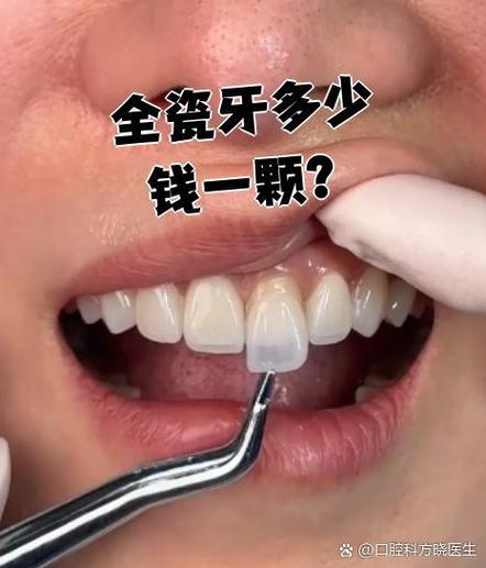 种一牙六千韩国烤瓷牙，价格合理质量有保障吗？-图1