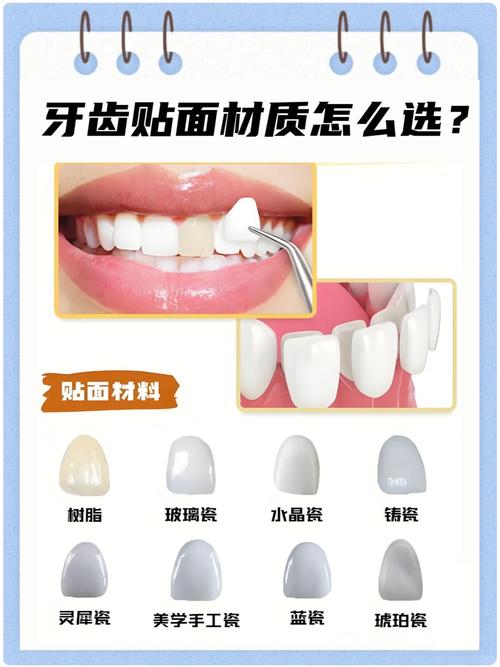 树脂牙齿抛光最简单方法-图2