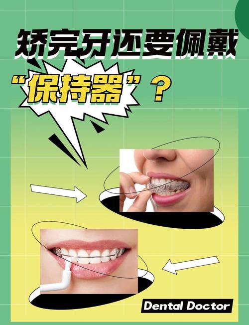 正畸保持器如何调整形状-图3