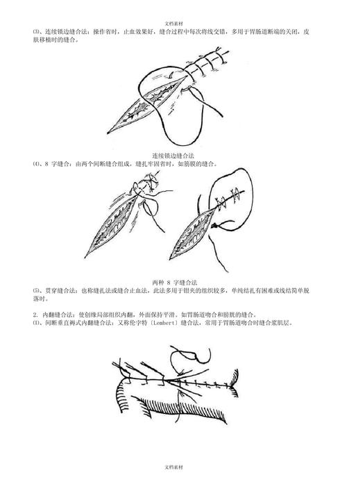 翻瓣手术缝合常用方法有哪些？-图3