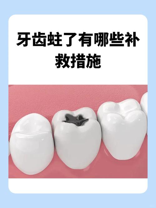 蛀牙有哪些方法能避免它蛀？如何有效预防？-图1