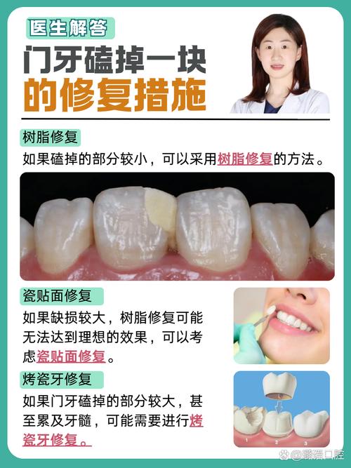 牙齿掉了,哪种修复方法最佳?-图1 牙齿掉了,哪种修复方法最佳?-图1