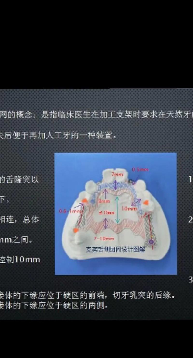 义齿支架打磨的制作方法-图1