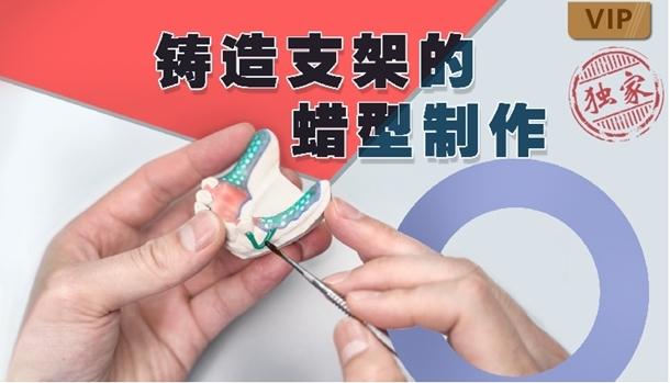 义齿支架打磨的制作方法-图3