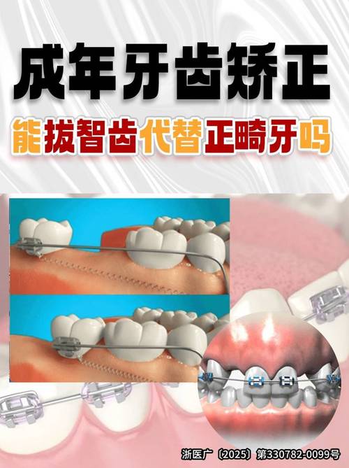 正畸时,横向阻生齿是否必须拔除?不拔会影响矫正效果吗?-图2 正畸时,横向阻生齿是否必须拔除?不拔会影响矫正效果吗?-图2