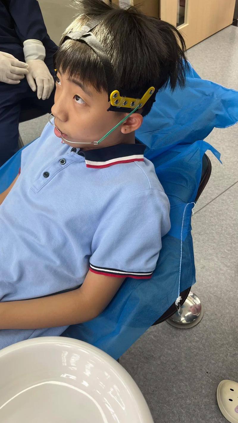 戴正畸头帽期间,还能正常吃东西吗?-图1 戴正畸头帽期间,还能正常吃东西吗?-图1