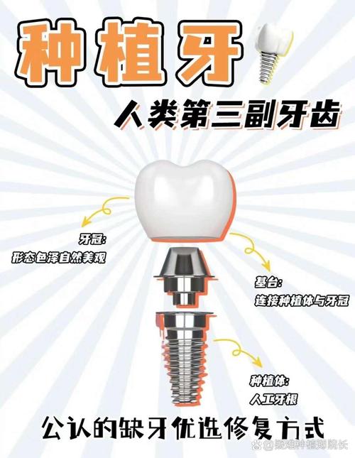 种牙的材料究竟是什么？都有哪些种类和材质？-图1