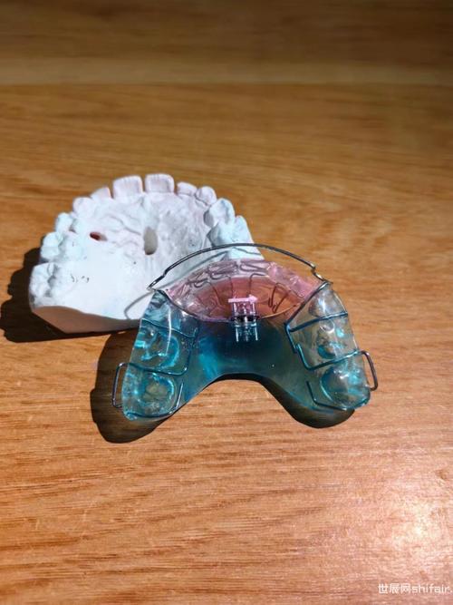 唇弓错位修复用什么方法?不同错位情况如何选择修复方案?-图1 唇弓错位修复用什么方法?不同错位情况如何选择修复方案?-图1