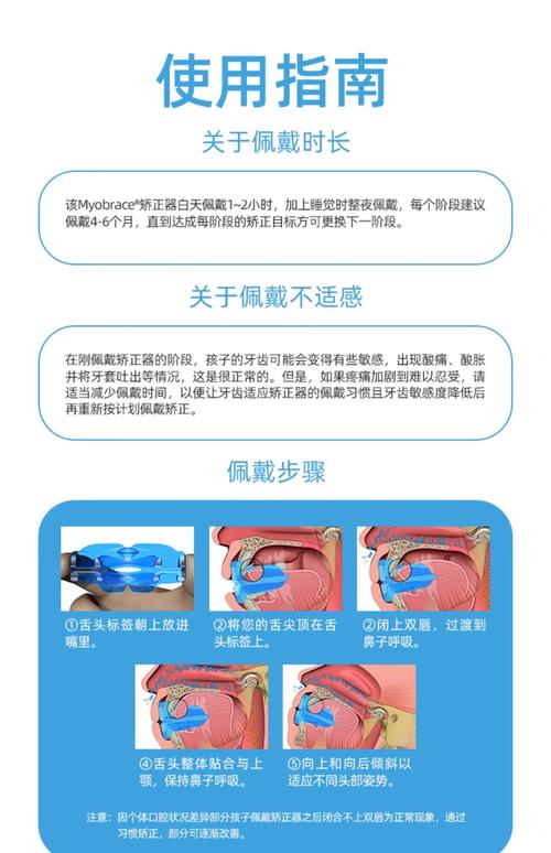 唇弓错位修复用什么方法?不同错位情况如何选择修复方案?-图2 唇弓错位修复用什么方法?不同错位情况如何选择修复方案?-图2