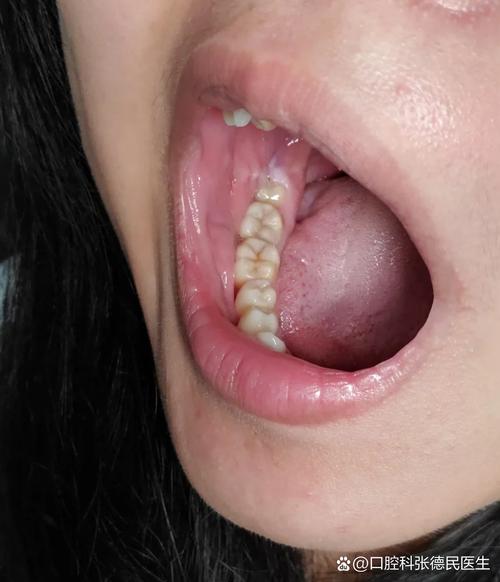 刚种完牙就怀孕会对母体、种植牙及胎儿健康有影响吗?-图2 刚种完牙就怀孕会对母体、种植牙及胎儿健康有影响吗?-图2