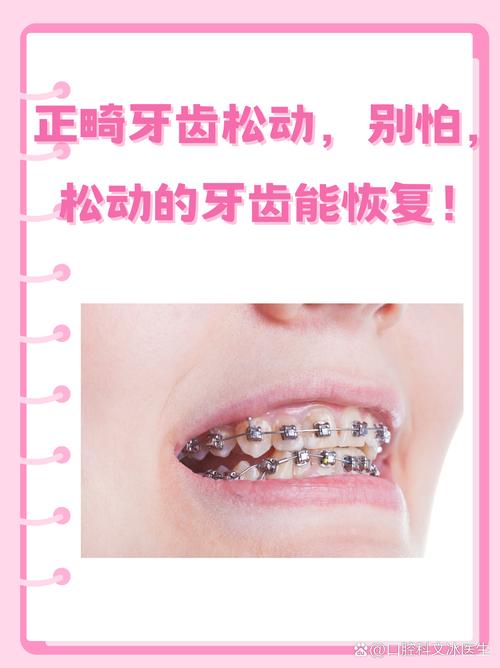 加速牙齿正畸移动的方法-图3