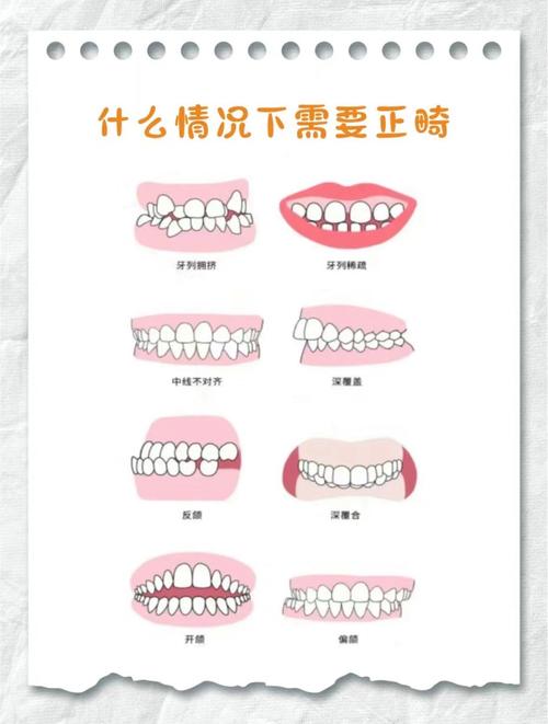 口腔颌面科VS正畸科，区别在哪？该挂哪个？-图2