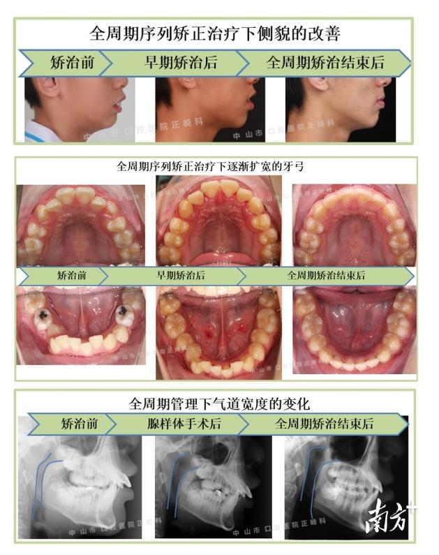 中山口腔医院正畸科的电话号码是多少?-图3 中山口腔医院正畸科的电话号码是多少?-图3