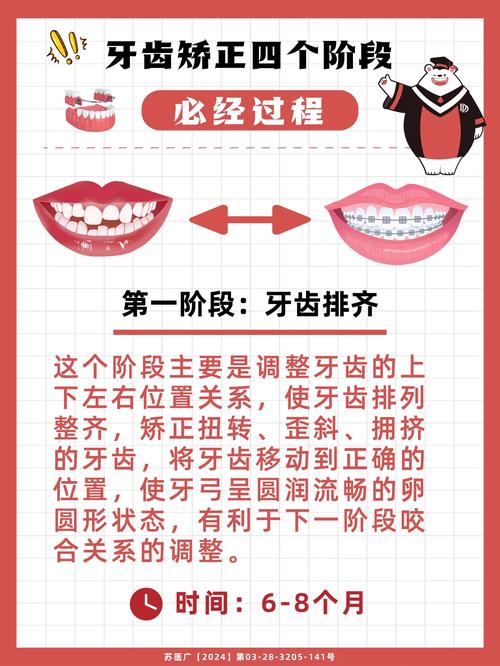 全国哪里正畸最佳方法怎么选?-图2 全国哪里正畸最佳方法怎么选?-图2