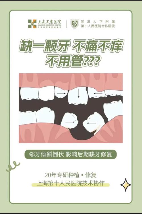 为什么十八岁才能种牙-图3 为什么十八岁才能种牙-图3