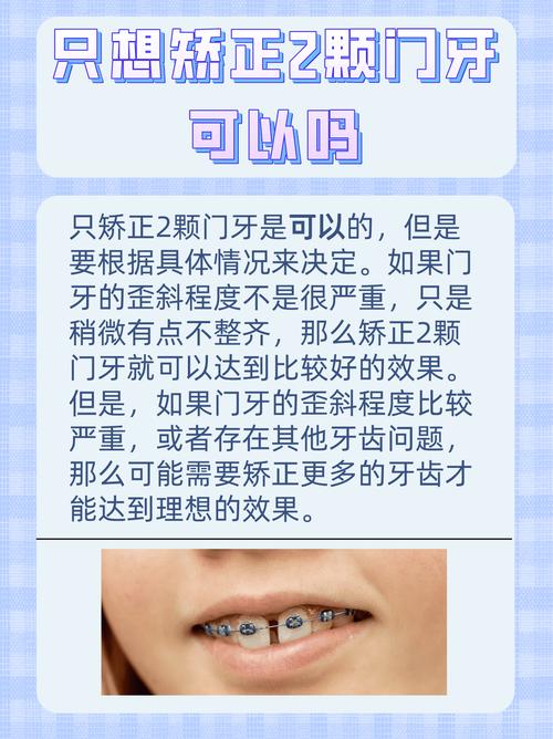 门牙修补后还能做正畸吗?-图2 门牙修补后还能做正畸吗?-图2