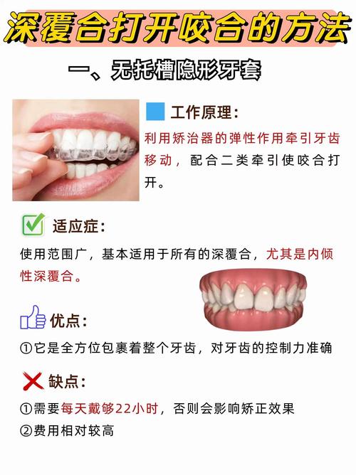 口腔正畸矫正治疗时，牙齿中线在矫正阶段什么时候定最佳时间？-图2