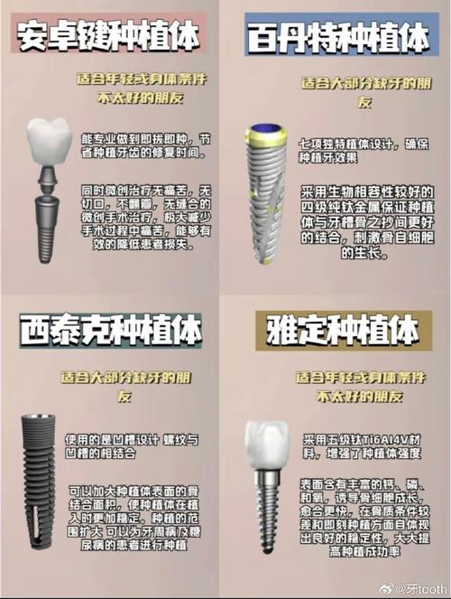目前种牙有哪些主流种植体品牌及类型？-图2