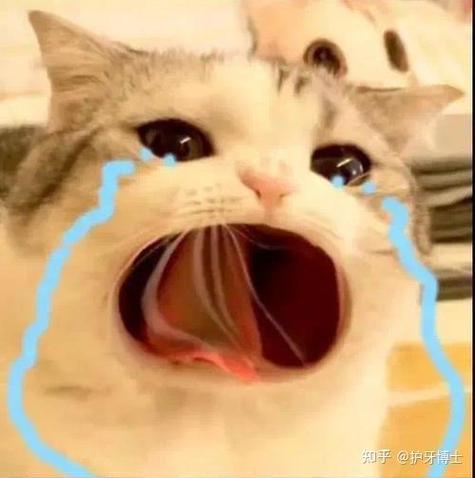 瑞典诺贝尔种植牙一颗要多少钱？-图2