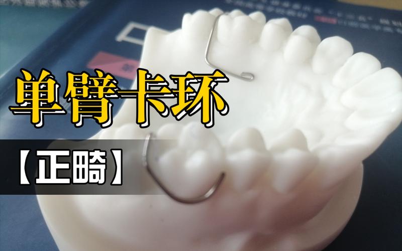 正畸箭头卡环弯制视频，如何掌握正确弯制方法？-图1