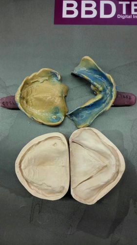 功能性印模制取方法图中的关键操作如何通过图示理解？-图3