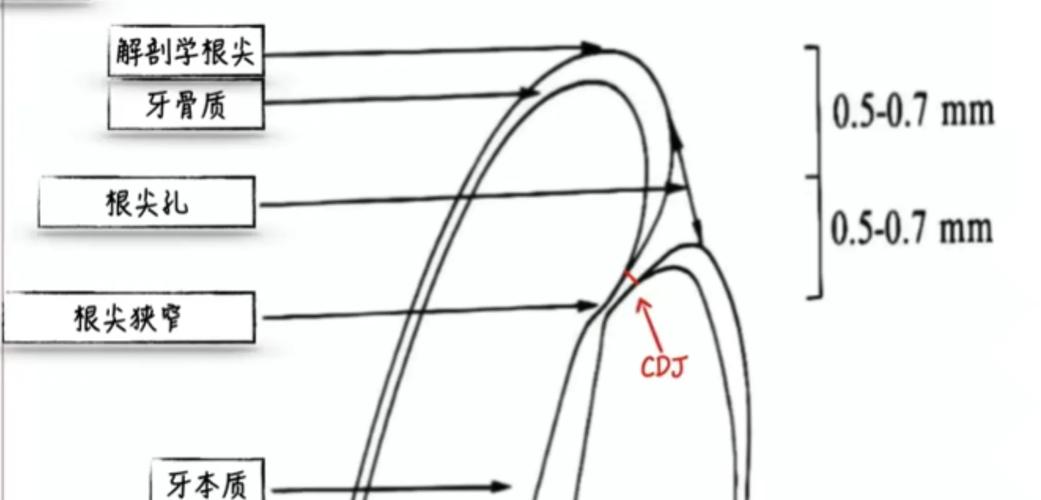根管测量台如何正确使用？操作步骤与注意事项详解-图2