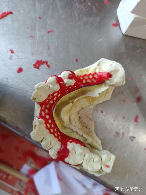 支架蜡型腊堤的正确制作方法中,详细步骤和操作要点有哪些?-图2 支架蜡型腊堤的正确制作方法中,详细步骤和操作要点有哪些?-图2