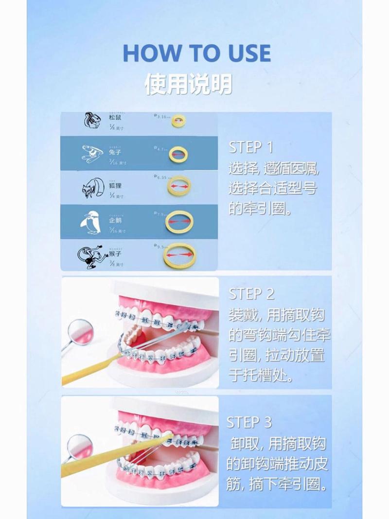 正畸牵引钩如何正确使用？操作步骤与注意事项有哪些？-图3