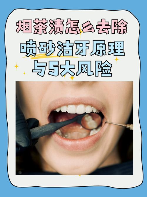牙茶渍怎么简单变白？有哪些快速有效的方法？-图1