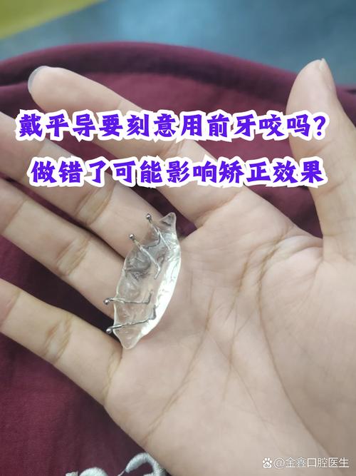 上前牙平导的制作方法详细步骤是怎样的?-图1 上前牙平导的制作方法详细步骤是怎样的?-图1