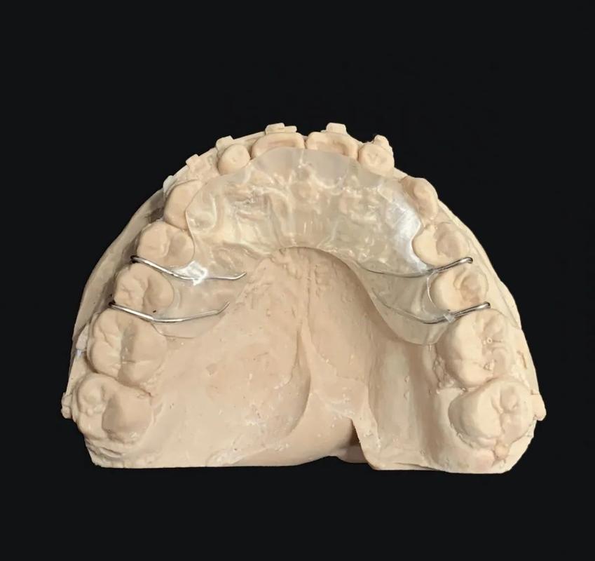 上前牙平导的制作方法详细步骤是怎样的?-图2 上前牙平导的制作方法详细步骤是怎样的?-图2