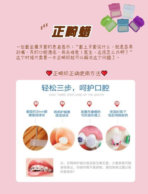 正畸牙齿垫石膏有哪些注意事项？关键要点需了解-图2