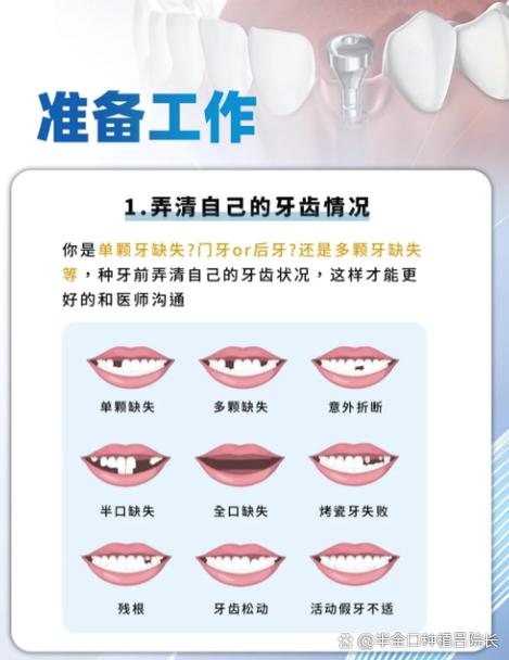 种植牙可以种黄金吗？黄金种植牙是否可行？-图1
