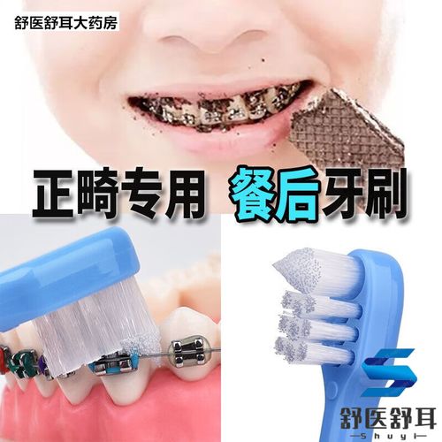 牙博士正畸费用能刷医保报销吗？-图2