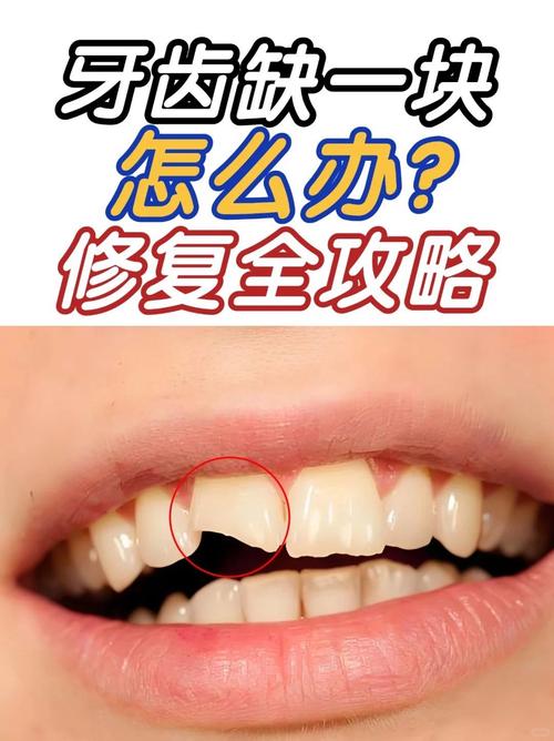 牙齿根缺损的修复方法-图2