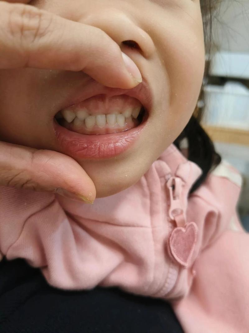 正畸完成后是否需要照片-图1 正畸完成后是否需要照片-图1