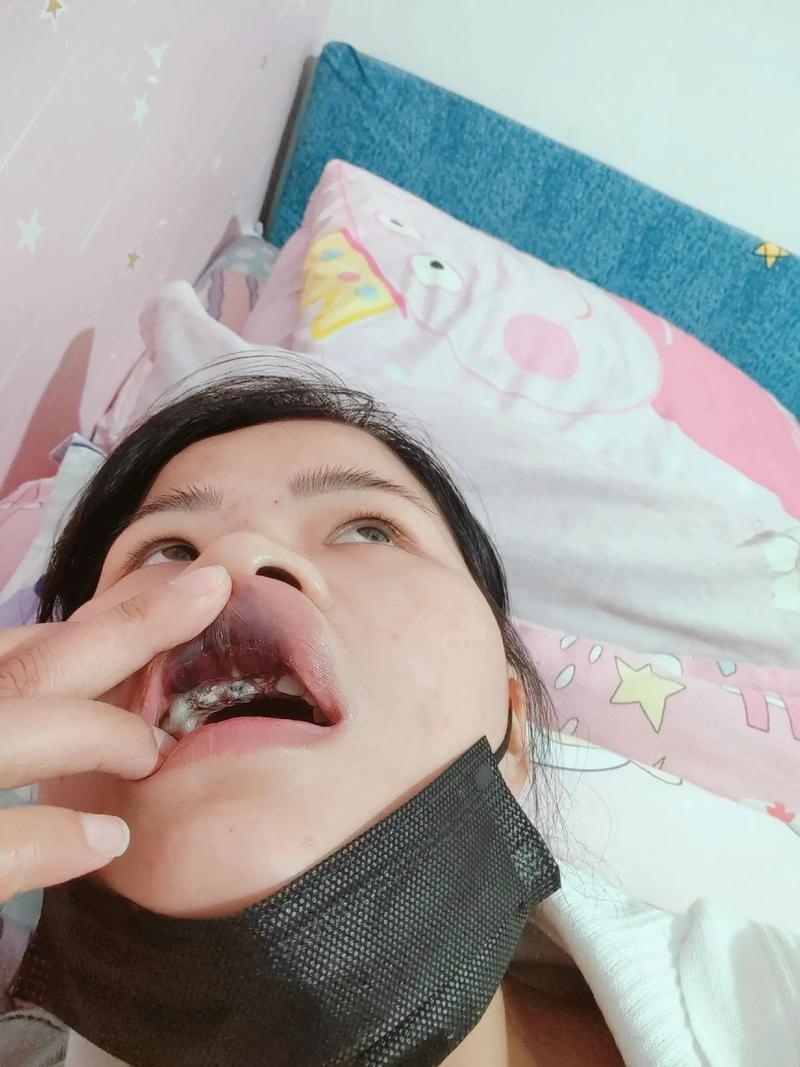 即拔即种牙手术疼不疼？真实感受到底如何？-图1