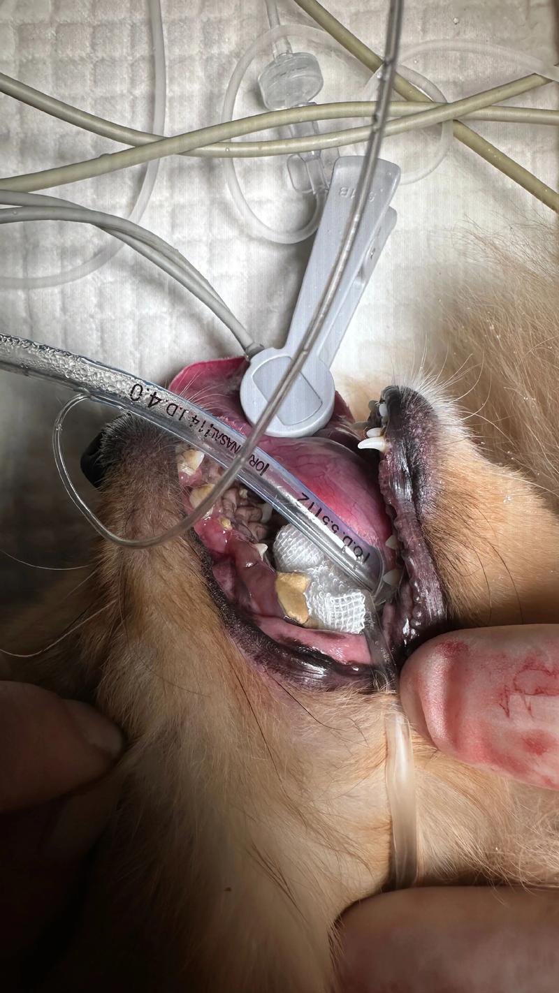 超声波洁牙的方法步骤-图3