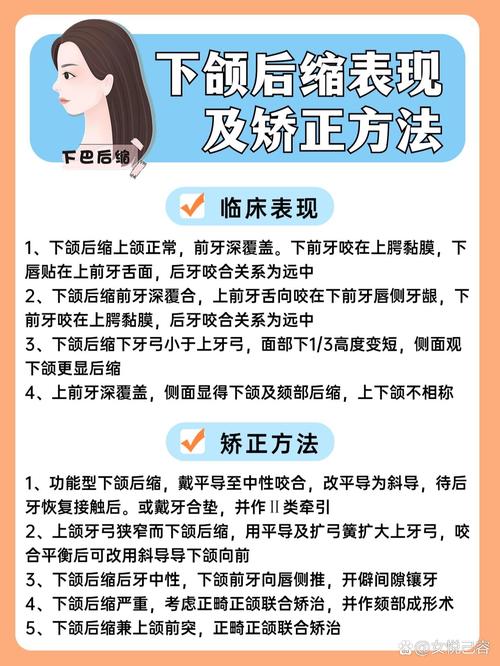 如何改善下颌骨后缩？有哪些可行方法？-图2