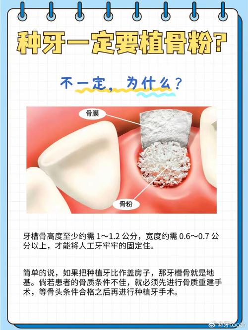 种牙后吃哪些食物能促进伤口愈合与口腔功能恢复？-图2