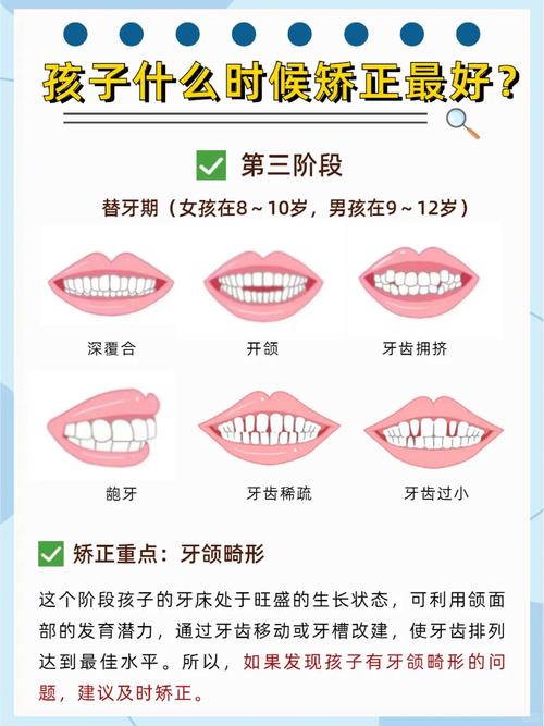 前牙正畸移动范围多大?受哪些解剖及生物因素影响?-图3 前牙正畸移动范围多大?受哪些解剖及生物因素影响?-图3